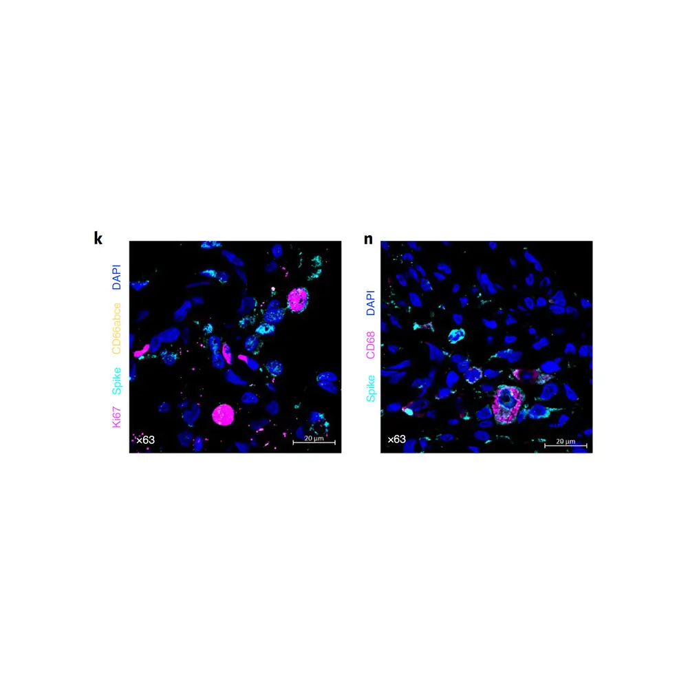 ProSci 3525_S SARS-CoV-2 (COVID-19) Spike Antibody, ProSci, 0.02 mg/Unit Primary Image