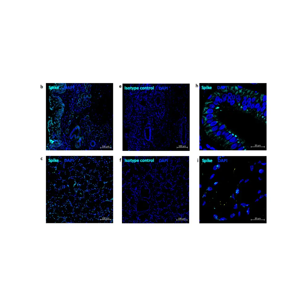 ProSci 3525 SARS-CoV-2 (COVID-19) Spike Antibody, ProSci, 0.1 mg/Unit Secondary Image