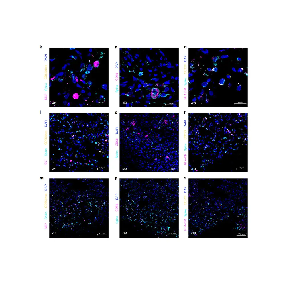 ProSci 3525 SARS-CoV-2 (COVID-19) Spike Antibody, ProSci, 0.1 mg/Unit Tertiary Image