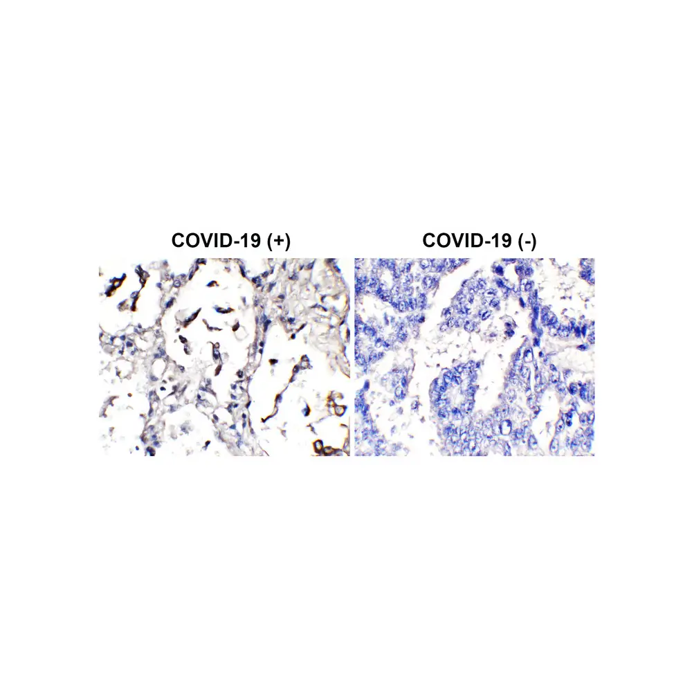 ProSci 3525-HRP SARS-CoV-2 (COVID-19) Spike Antibody (HRP), ProSci, 0.1 mg/Unit Primary Image