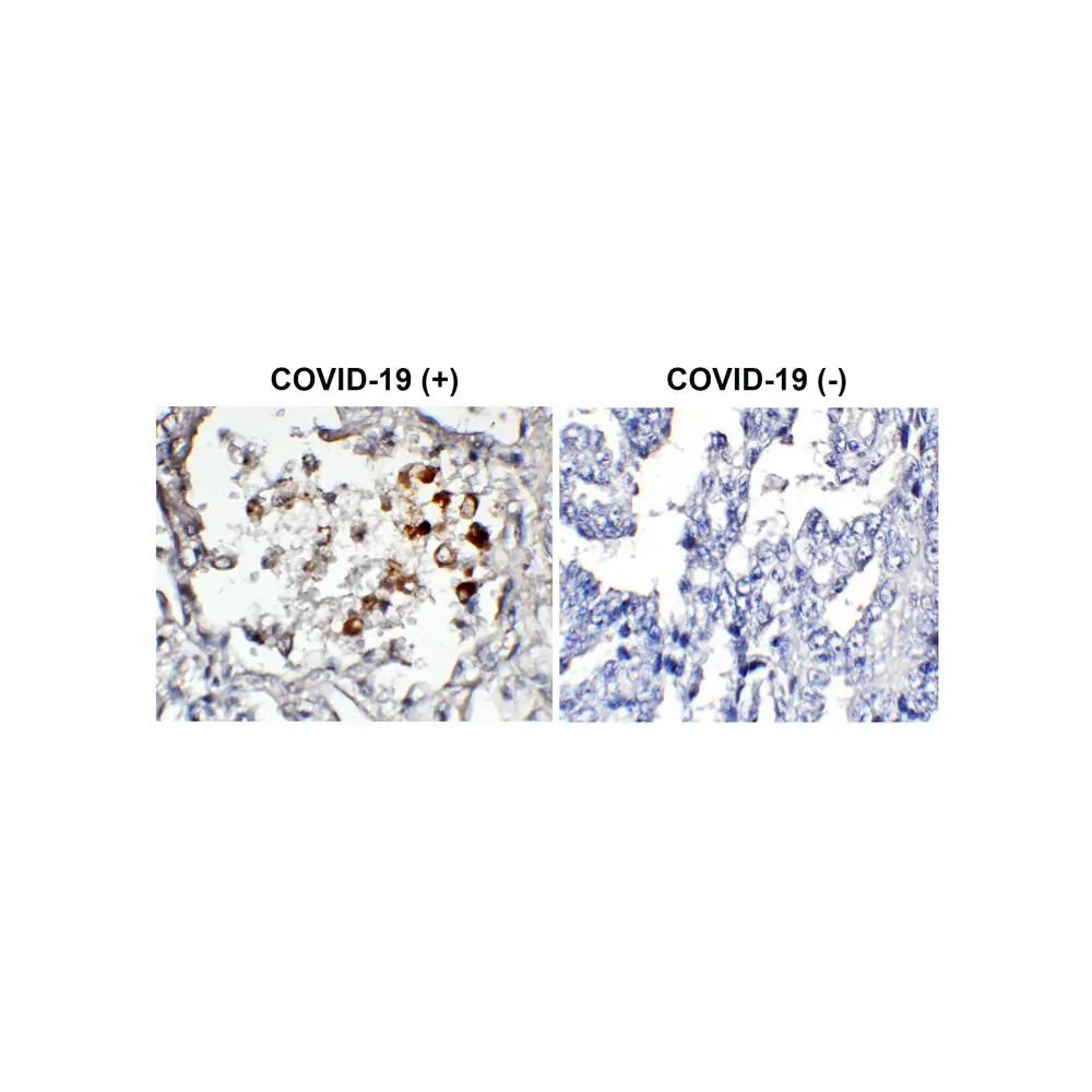 ProSci 3525-biotin SARS-CoV-2 (COVID-19) Spike Antibody (biotin), ProSci, 0.1 mg/Unit Primary Image