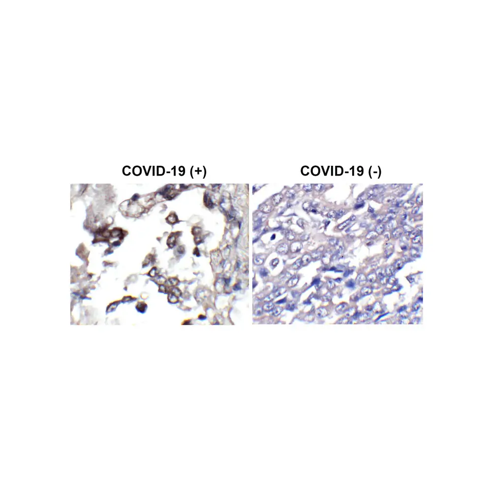 ProSci 3531-HRP_S SARS-CoV-2 (COVID-19) Envelope Antibody (HRP), ProSci, 0.02 mg/Unit Primary Image