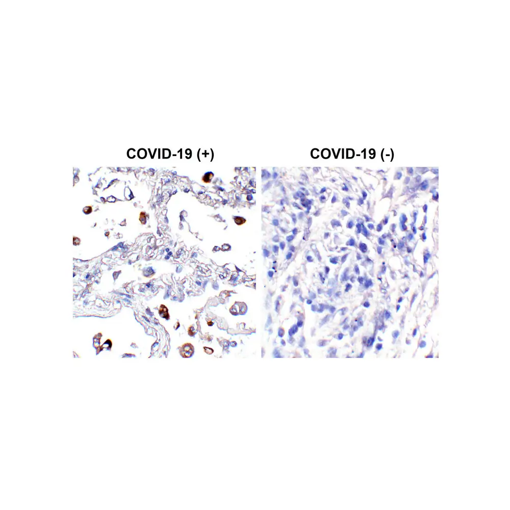 ProSci PM-9428 SARS-CoV-2 (COVID-19) Spike S2 Antibody [4F10], ProSci, 0.1 mg/Unit Primary Image