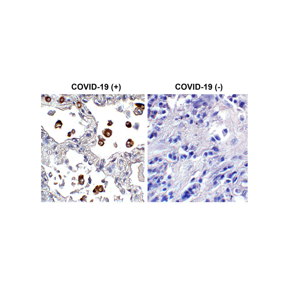 ProSci PM-9429 SARS-CoV-2 (COVID-19) Spike S2 Antibody [5E6], ProSci, 0.1 mg/Unit Primary Image