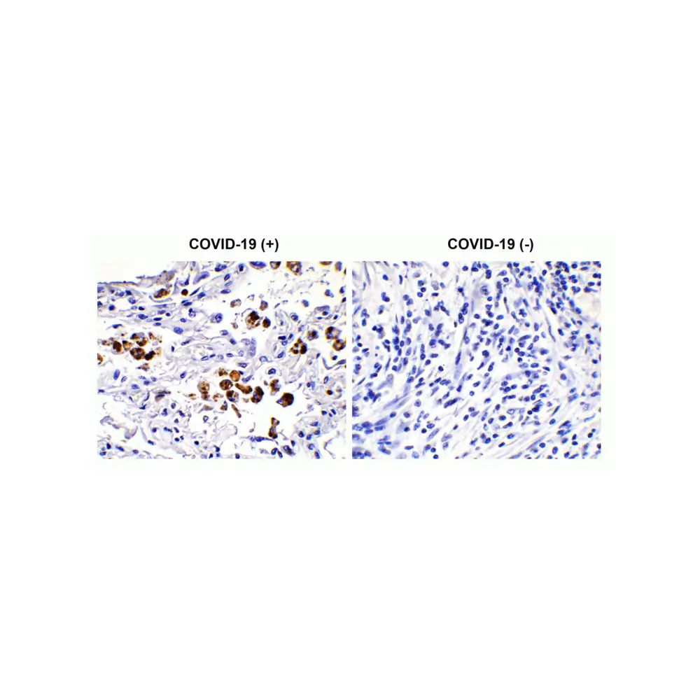 ProSci 9123_S SARS-CoV-2 (COVID-19) Spike S2 Antibody, ProSci, 0.02 mg/Unit Primary Image