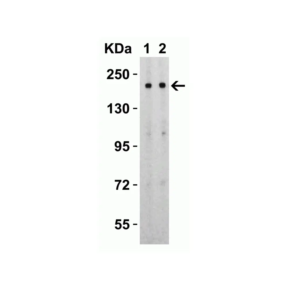 ProSci 9123_S SARS-CoV-2 (COVID-19) Spike S2 Antibody, ProSci, 0.02 mg/Unit Quaternary Image