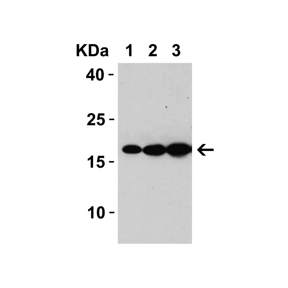 ProSci 3529 SARS-CoV Matrix Antibody, ProSci, 0.1 mg/Unit Primary Image