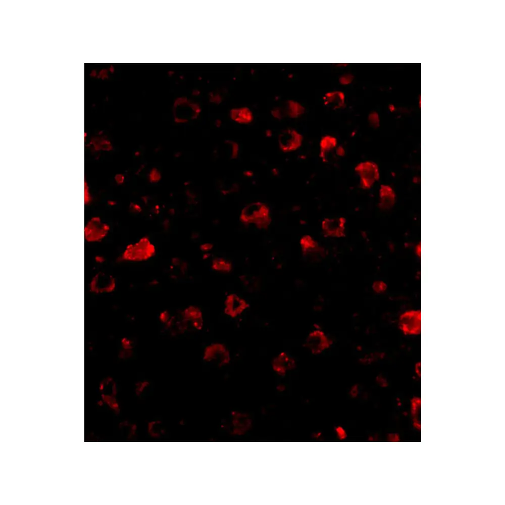 ProSci 4631_S SATB1 Antibody, ProSci, 0.02 mg/Unit Tertiary Image