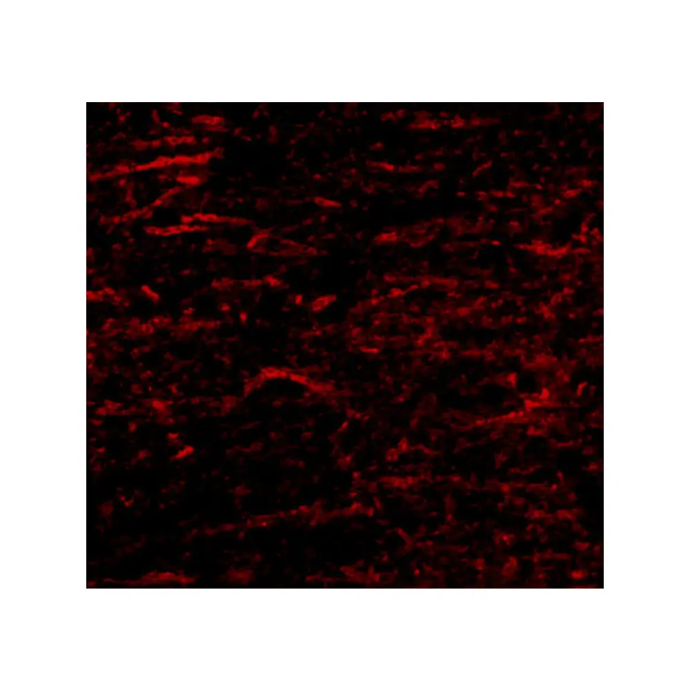 ProSci 4679 SATB1 Antibody, ProSci, 0.1 mg/Unit Tertiary Image