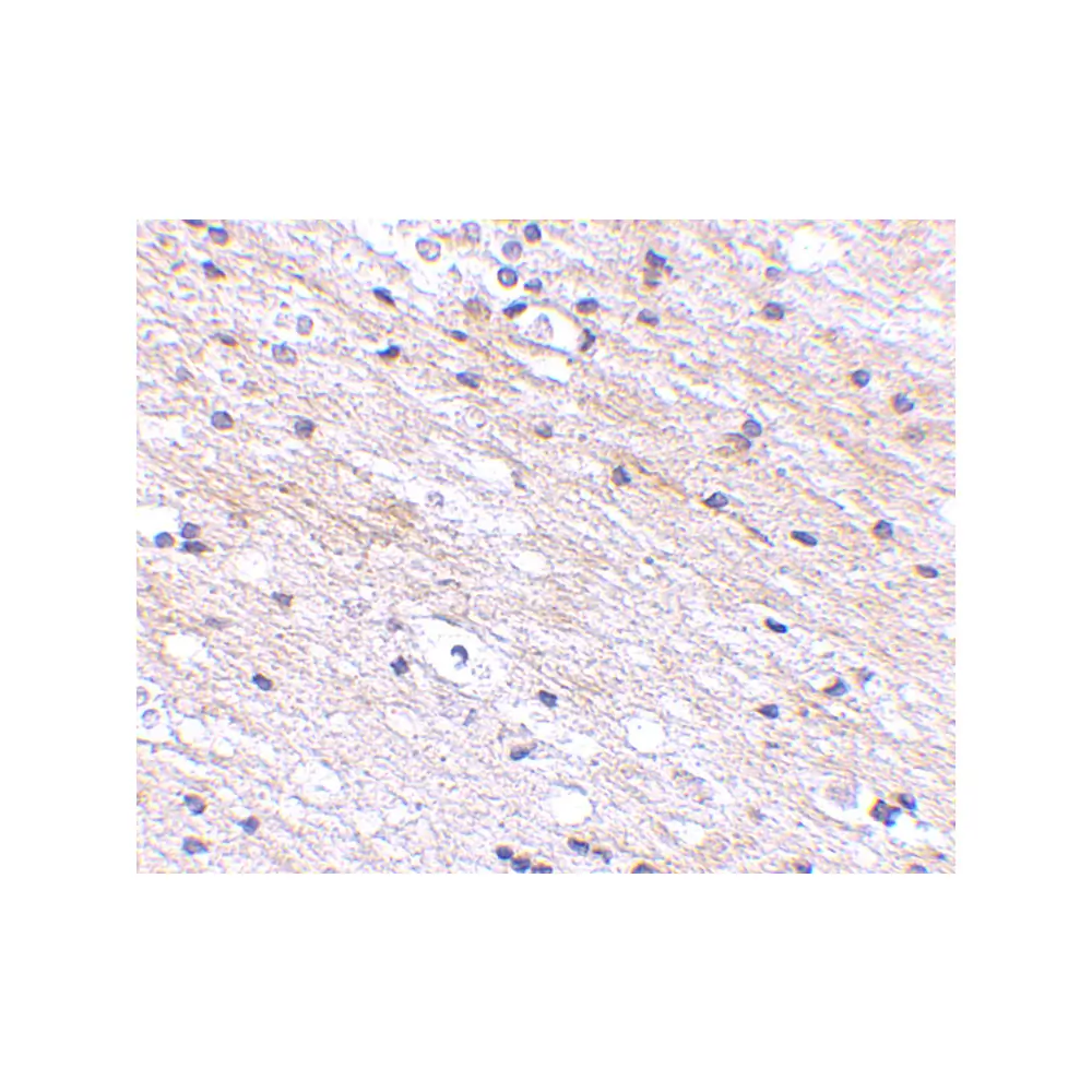 ProSci 4679 SATB1 Antibody, ProSci, 0.1 mg/Unit Secondary Image
