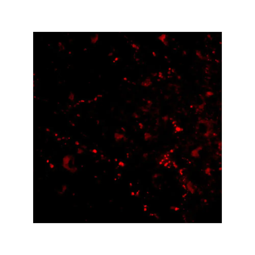 ProSci 4629_S SATB2 Antibody, ProSci, 0.02 mg/Unit Tertiary Image