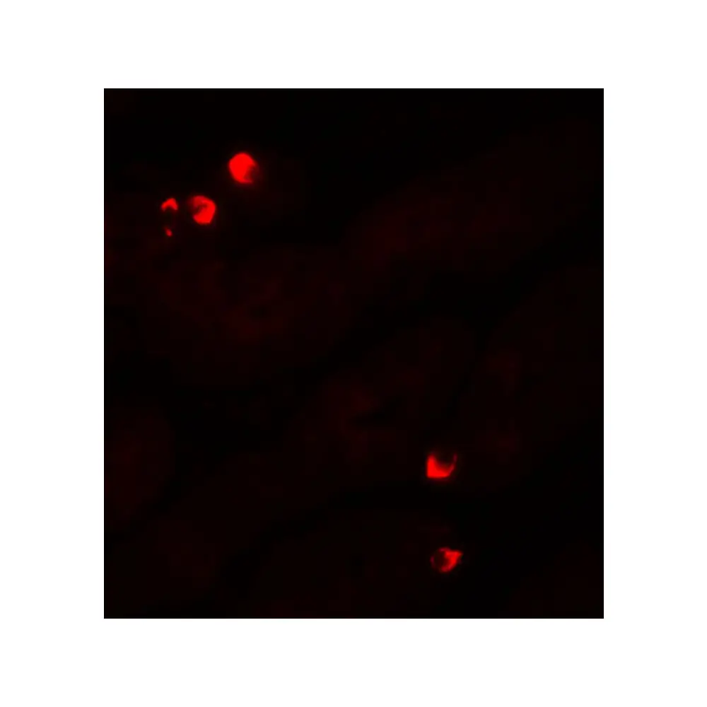 ProSci 6319 SGK1 Antibody, ProSci, 0.1 mg/Unit Tertiary Image