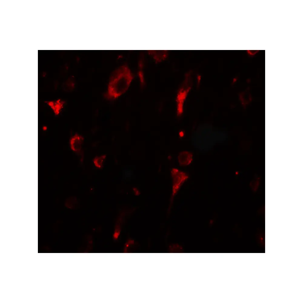 ProSci 7035_S SGSM2 Antibody, ProSci, 0.02 mg/Unit Secondary Image