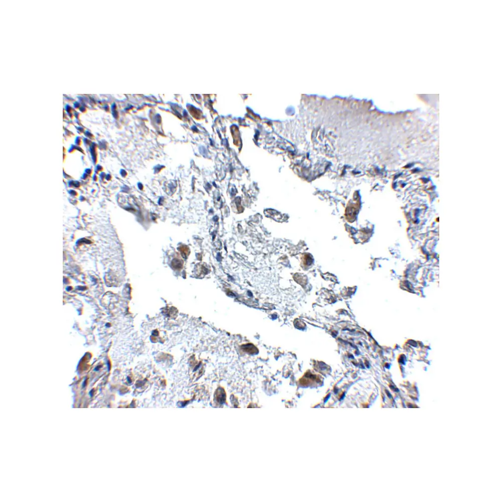 ProSci 5167_S SH3BP4 Antibody, ProSci, 0.02 mg/Unit Secondary Image