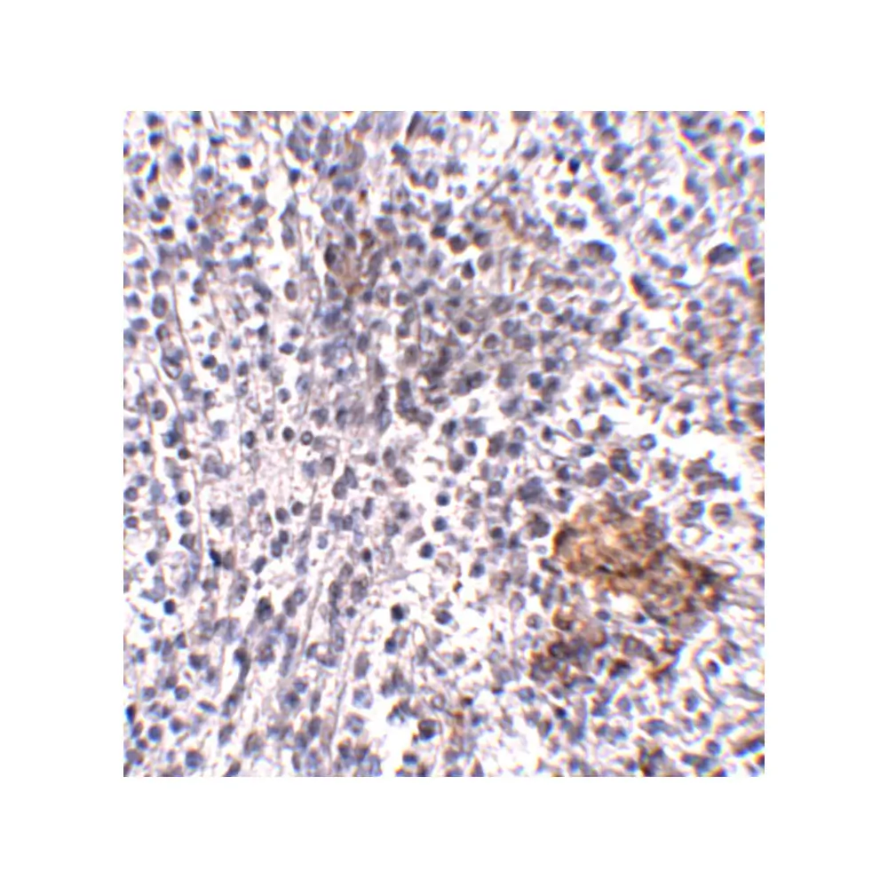 ProSci 5215 SHOC2 Antibody, ProSci, 0.1 mg/Unit Secondary Image