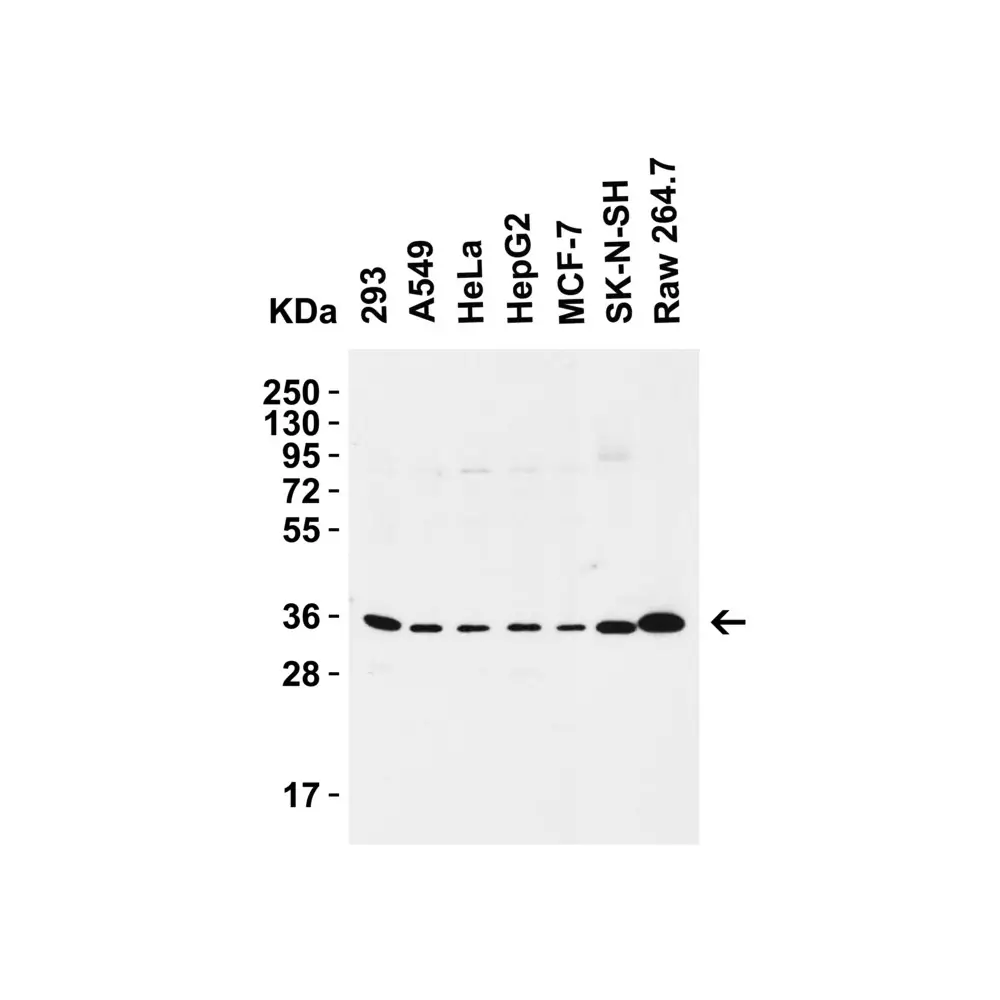 ProSci 9017_S SIGLEC15 Antibody, ProSci, 0.02 mg/Unit Primary Image