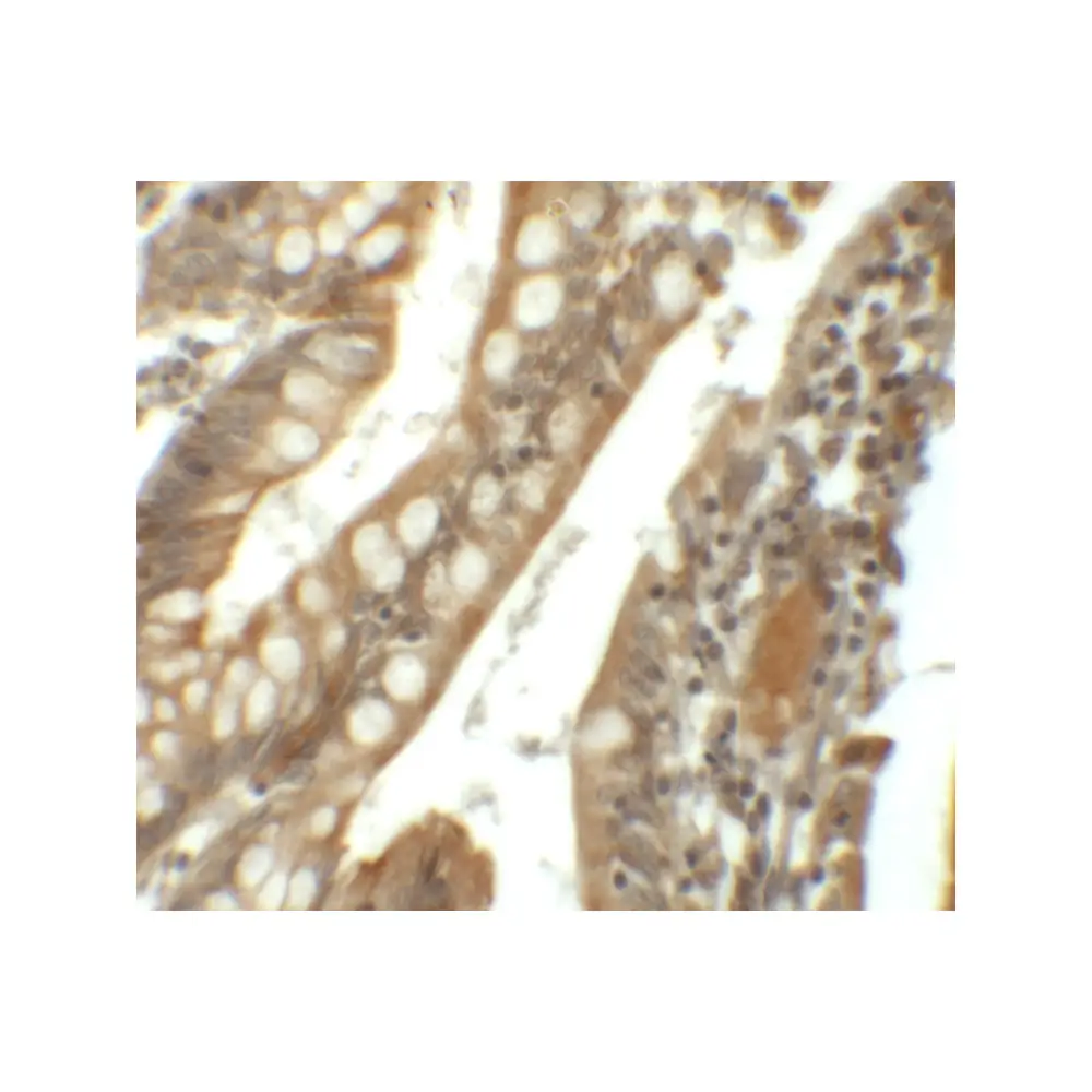 ProSci 6299 SIK1 Antibody, ProSci, 0.1 mg/Unit Secondary Image