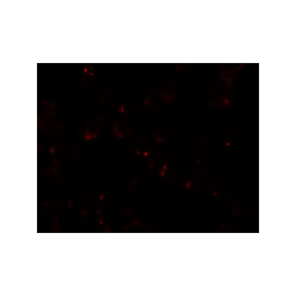ProSci 6301 SIK2 Antibody, ProSci, 0.1 mg/Unit Tertiary Image