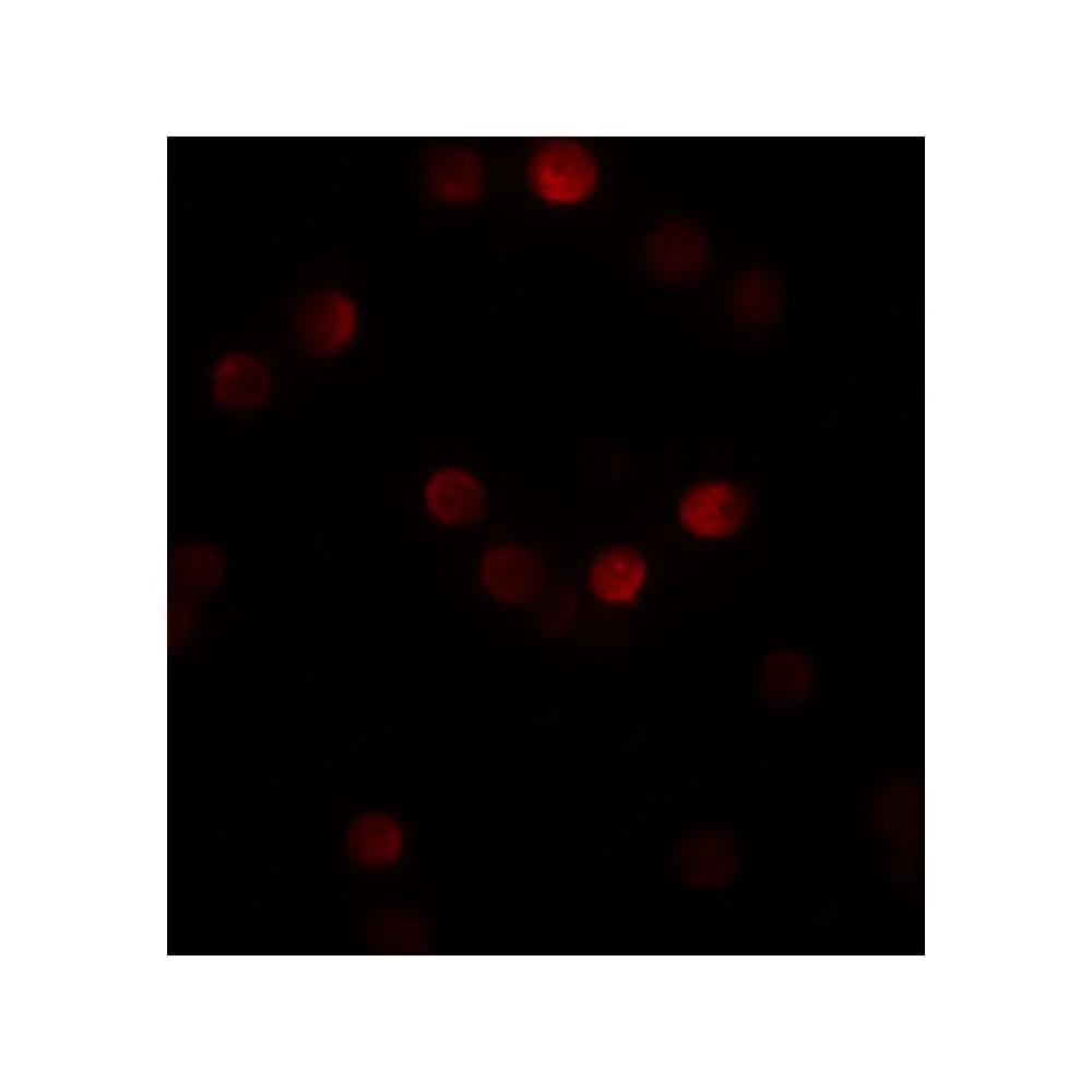 ProSci 5823 SIP1 Antibody, ProSci, 0.1 mg/Unit Tertiary Image