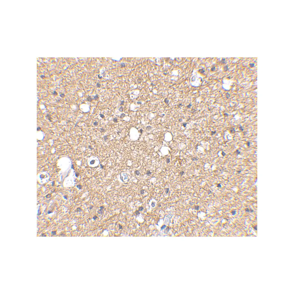 ProSci 4485_S SIRT2 Antibody, ProSci, 0.02 mg/Unit Secondary Image