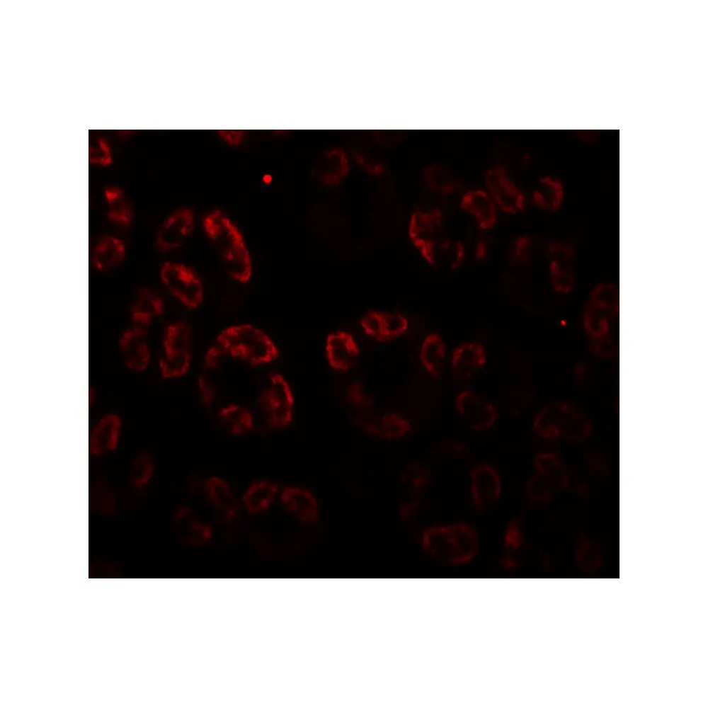 ProSci 7993 SKI2W Antibody, ProSci, 0.1 mg/Unit Tertiary Image