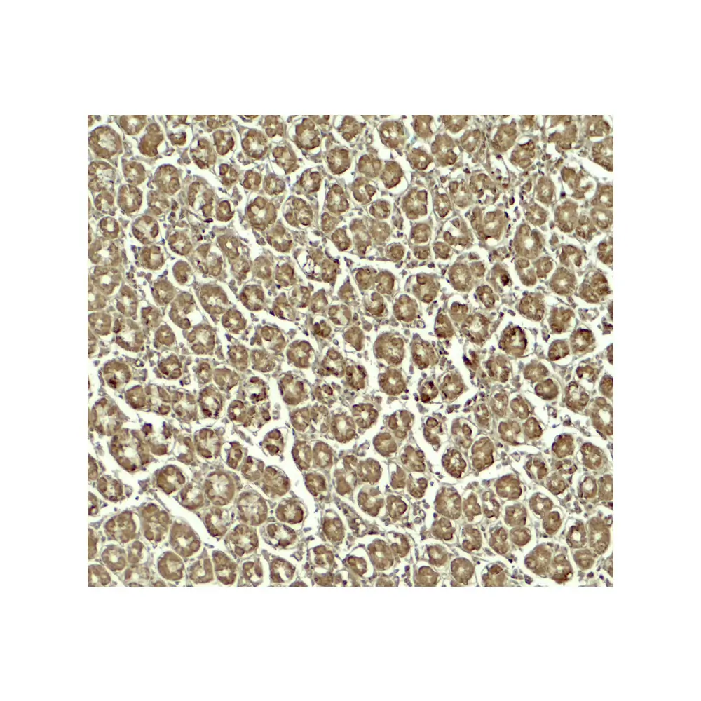 ProSci 7993 SKI2W Antibody, ProSci, 0.1 mg/Unit Secondary Image