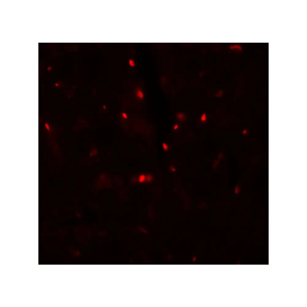 ProSci 7297_S SLC27A6 Antibody, ProSci, 0.02 mg/Unit Tertiary Image