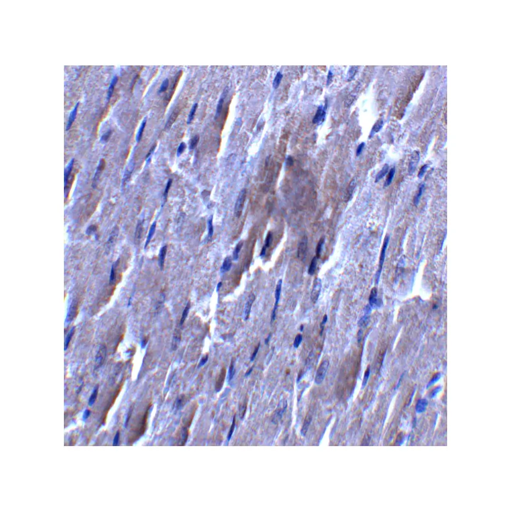 ProSci 7297_S SLC27A6 Antibody, ProSci, 0.02 mg/Unit Secondary Image