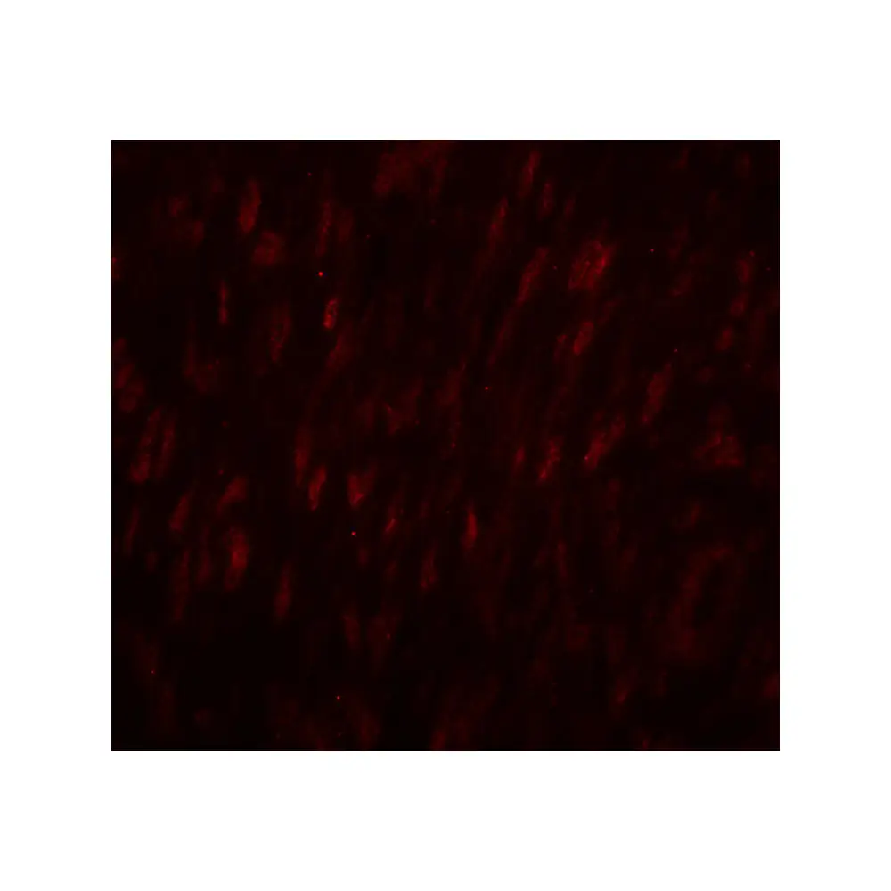 ProSci 8125_S SLC29A1 Antibody, ProSci, 0.02 mg/Unit Tertiary Image
