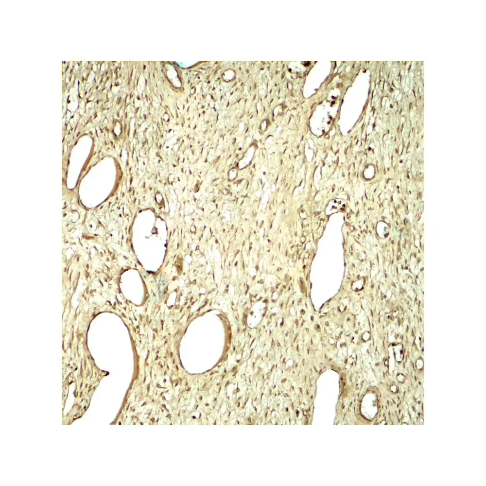 ProSci 8125_S SLC29A1 Antibody, ProSci, 0.02 mg/Unit Secondary Image