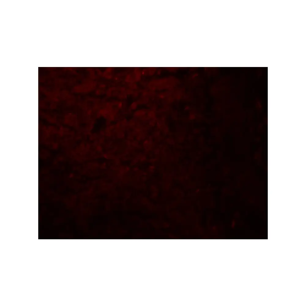 ProSci 8127_S SLC29A2 Antibody, ProSci, 0.02 mg/Unit Tertiary Image