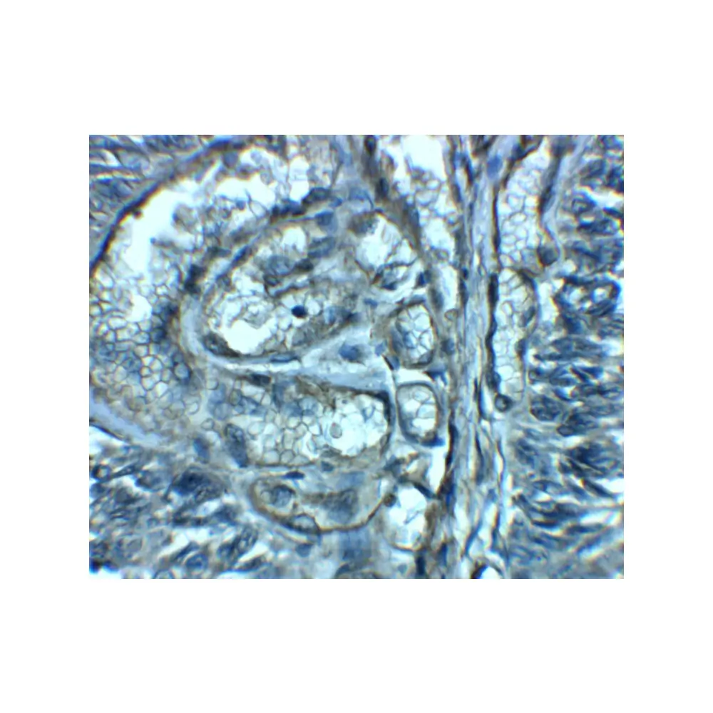 ProSci 8127 SLC29A2 Antibody, ProSci, 0.1 mg/Unit Secondary Image