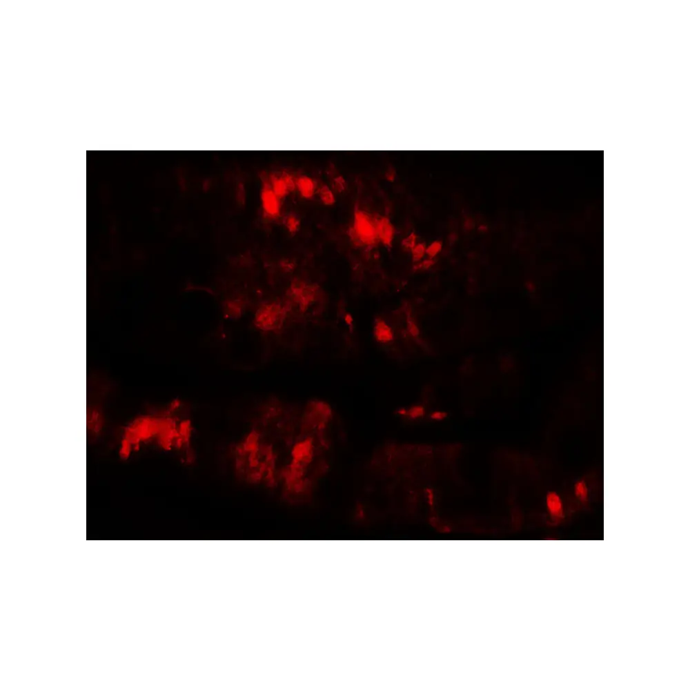ProSci 8129 SLC29A3 Antibody, ProSci, 0.1 mg/Unit Tertiary Image