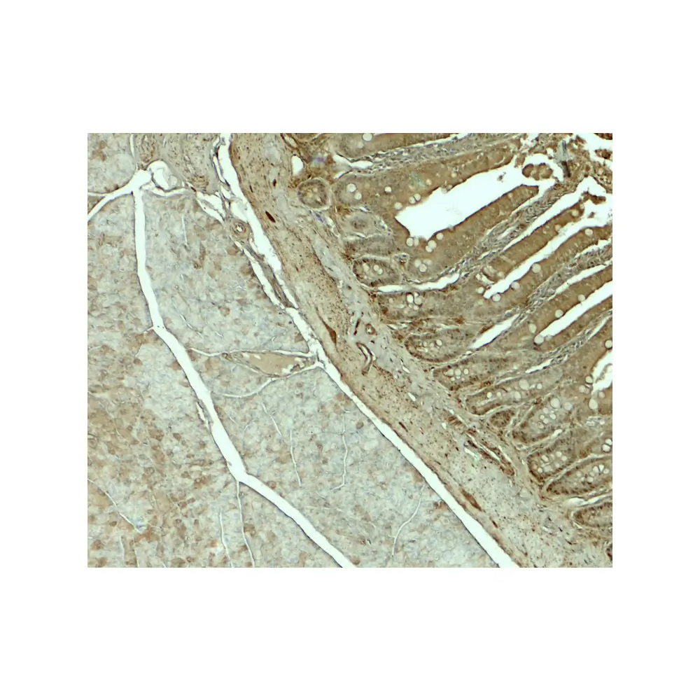 ProSci 8129_S SLC29A3 Antibody, ProSci, 0.02 mg/Unit Secondary Image