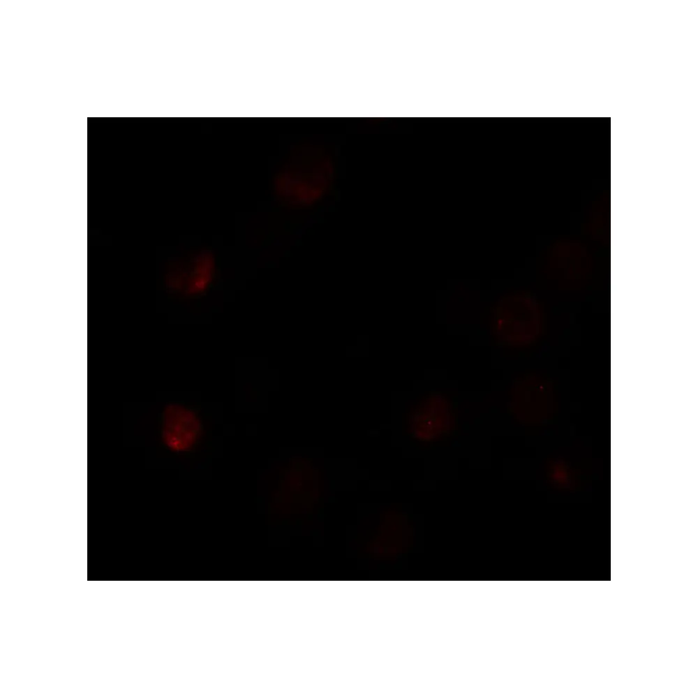 ProSci 6547_S SLC35D3 Antibody, ProSci, 0.02 mg/Unit Tertiary Image