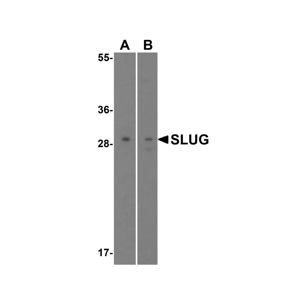 ProSci 3959 Slug Antibody, ProSci, 0.1 mg/Unit Quaternary Image