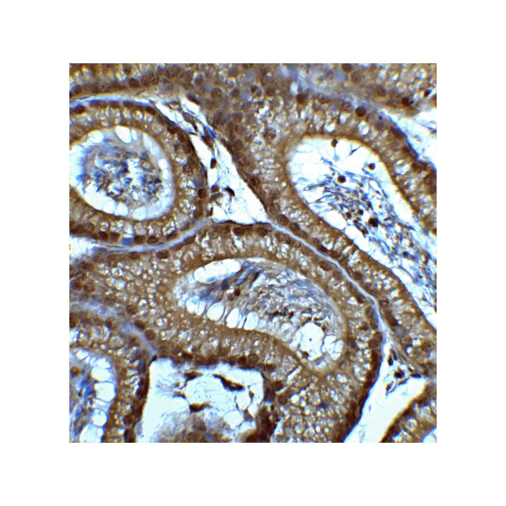 ProSci 7749 SMARCA4 Antibody, ProSci, 0.1 mg/Unit Quaternary Image