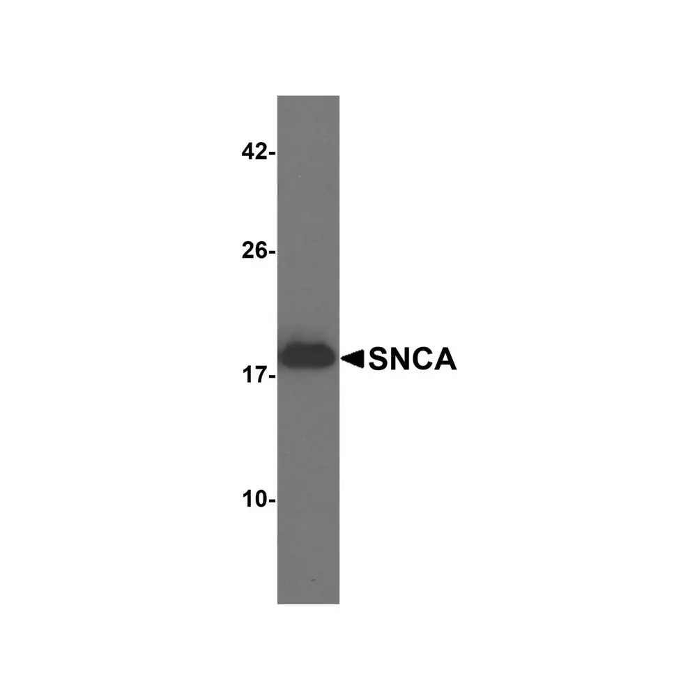 ProSci 7911 SNCA Antibody, ProSci, 0.1 mg/Unit Quaternary Image