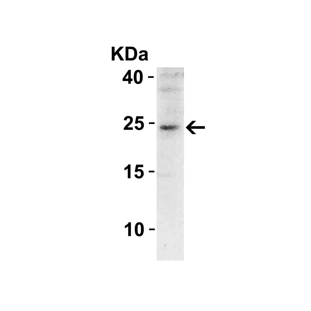 ProSci 3767 SOCS1 Antibody, ProSci, 0.1 mg/Unit Primary Image
