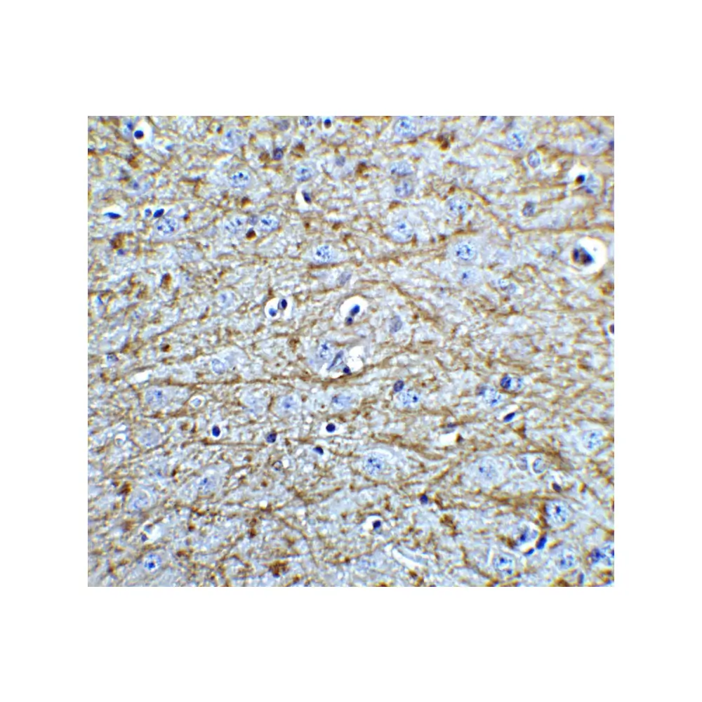 ProSci 5583_S SOX2 Antibody, ProSci, 0.02 mg/Unit Quaternary Image