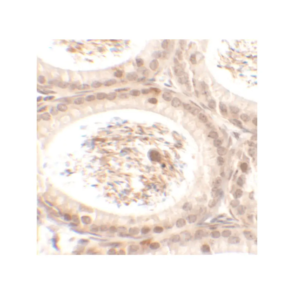 ProSci 6551 SPATA3 Antibody, ProSci, 0.1 mg/Unit Secondary Image