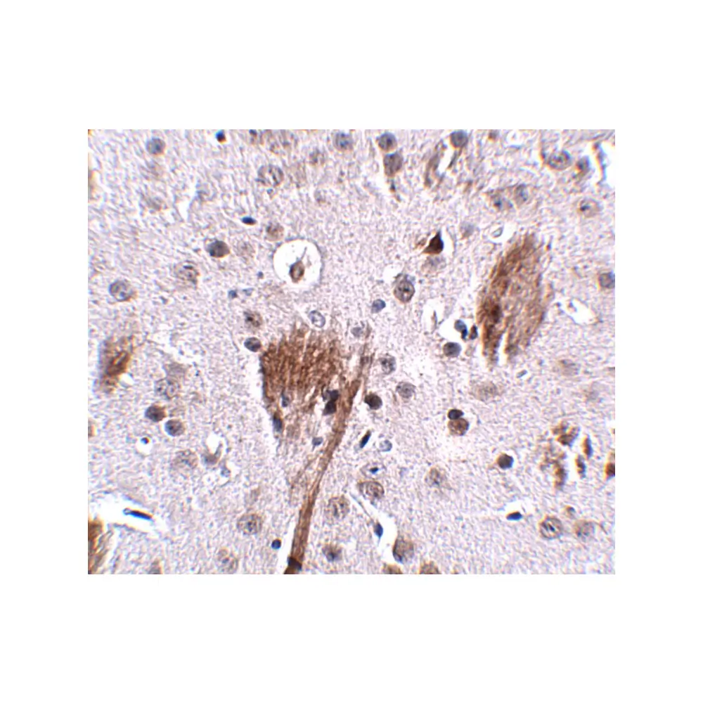 ProSci 5015 SPG11 Antibody, ProSci, 0.1 mg/Unit Secondary Image