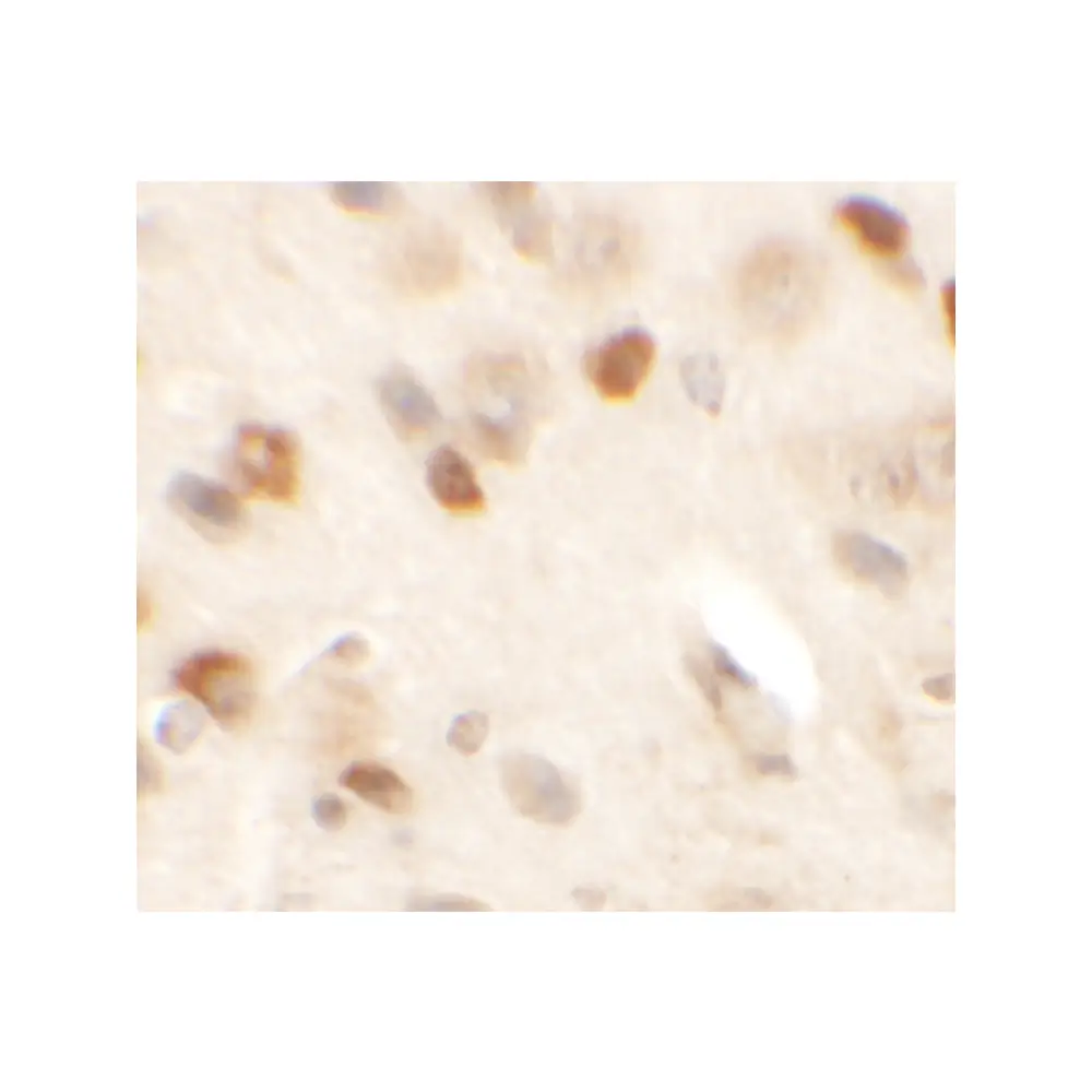 ProSci 6403 SPRYD2 Antibody, ProSci, 0.1 mg/Unit Secondary Image