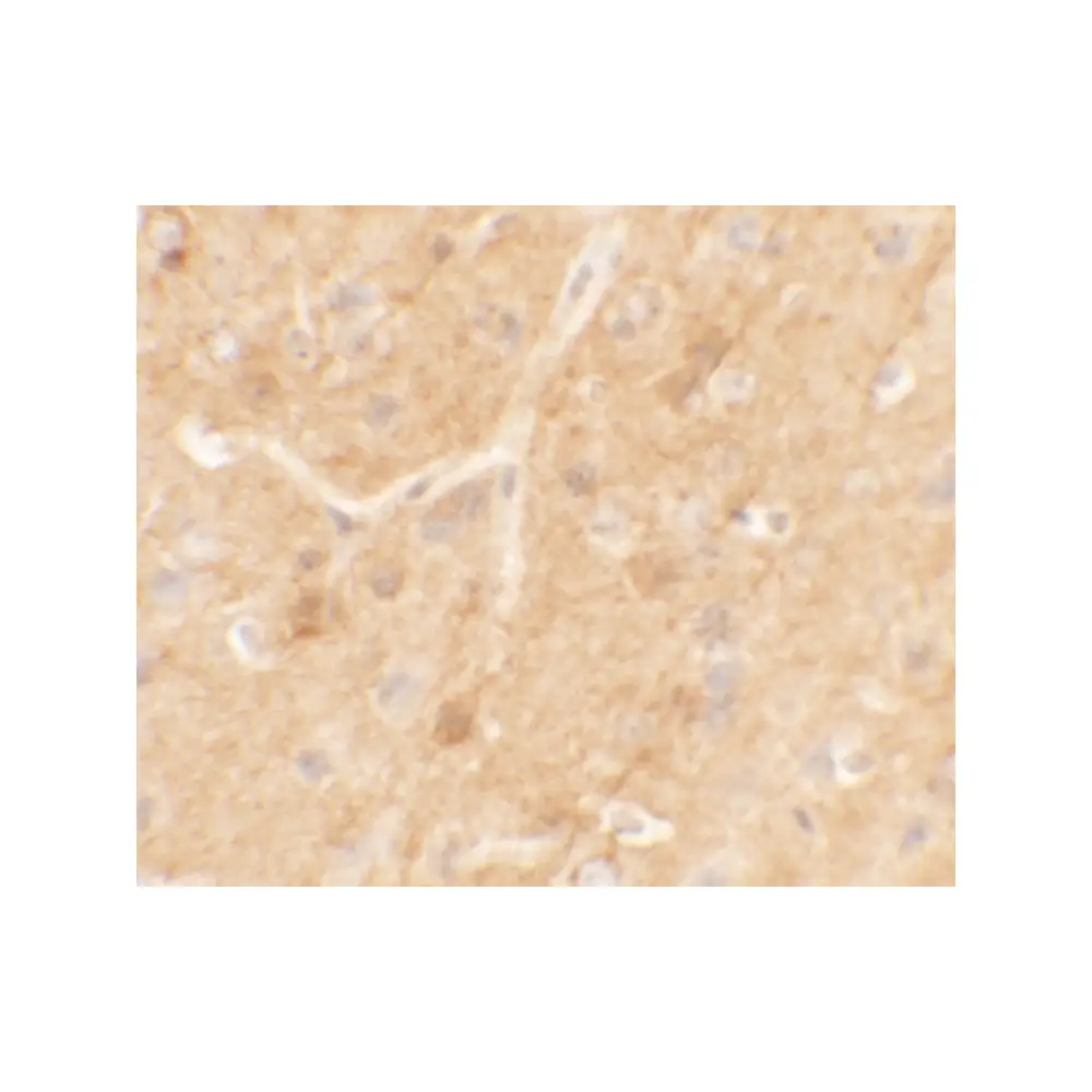 ProSci 6409_S SPRYD5 Antibody, ProSci, 0.02 mg/Unit Secondary Image