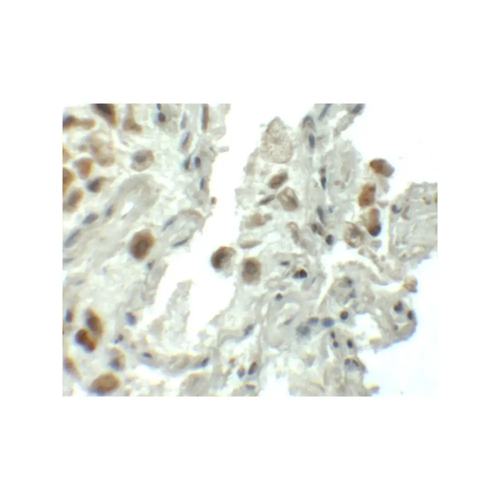 ProSci 6303_S SPT1 Antibody, ProSci, 0.02 mg/Unit Secondary Image