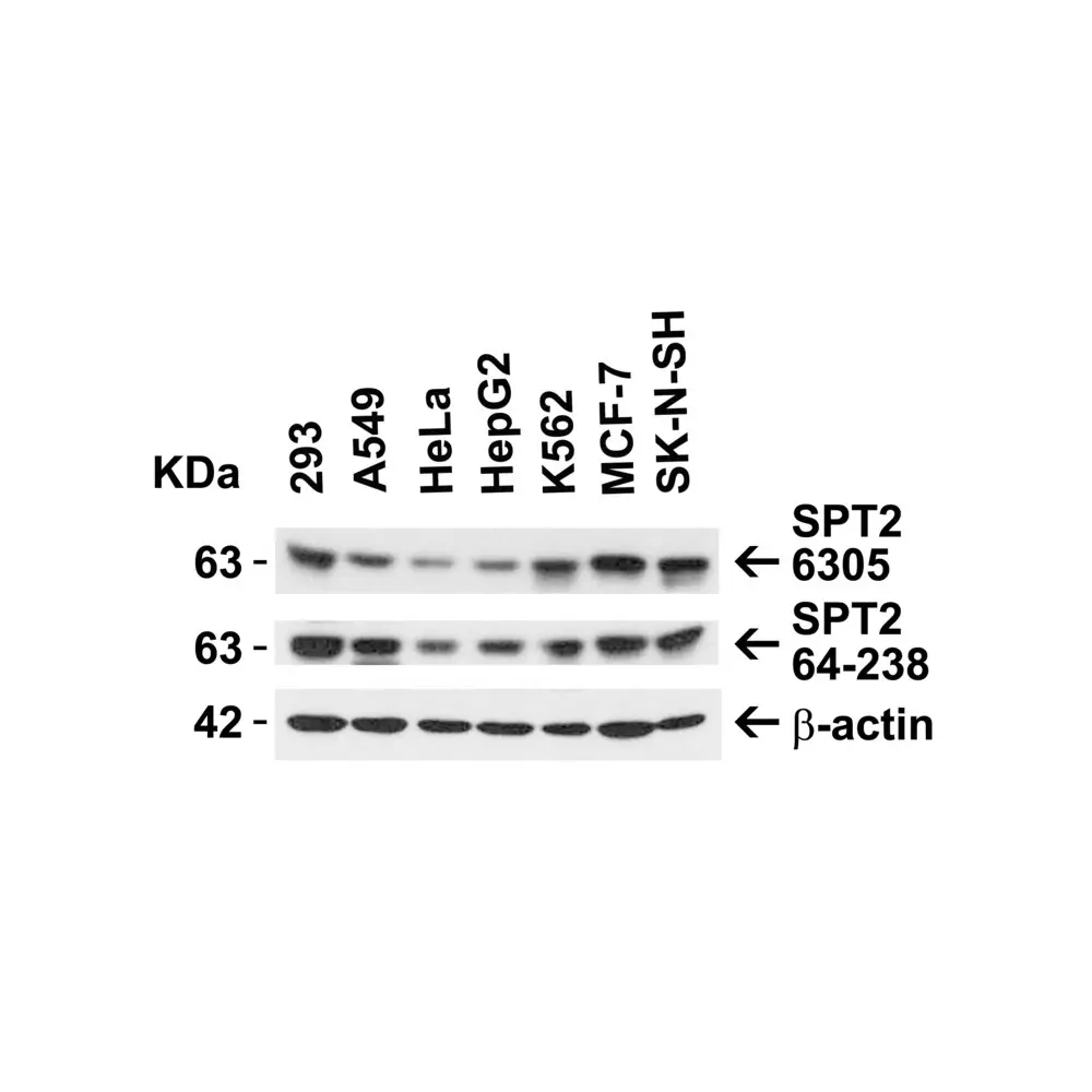 ProSci 6305 SPT2 Antibody, ProSci, 0.1 mg/Unit Primary Image