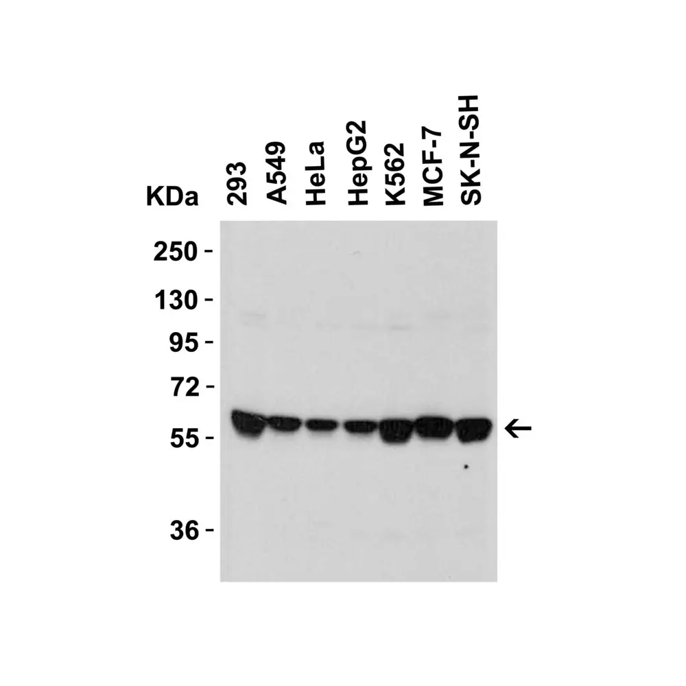 ProSci 6305_S SPT2 Antibody, ProSci, 0.02 mg/Unit Secondary Image