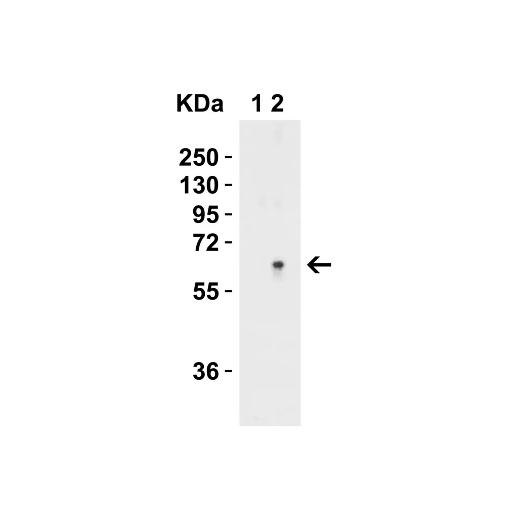 ProSci 6305_S SPT2 Antibody, ProSci, 0.02 mg/Unit Quaternary Image