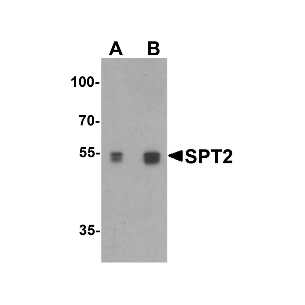 ProSci 6305_S SPT2 Antibody, ProSci, 0.02 mg/Unit Tertiary Image