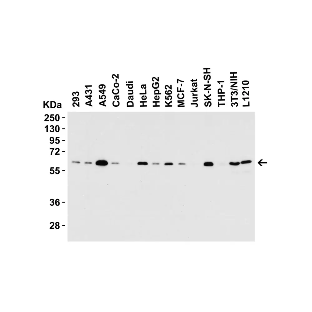 ProSci 5449_S SQSTM1 Antibody, ProSci, 0.02 mg/Unit Secondary Image